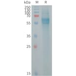 SDS-PAGE - Recombinant human FcRL2 Protein (6×His Tag) (A317721) - Antibodies.com