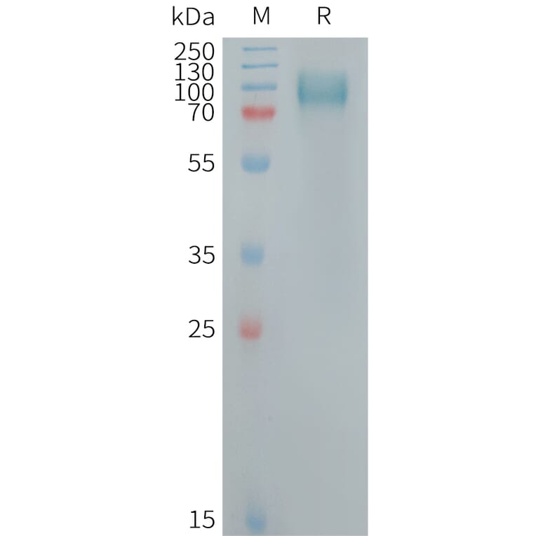 SDS-PAGE - Recombinant Human GPNMB Protein (6×His Tag) (A317722) - Antibodies.com