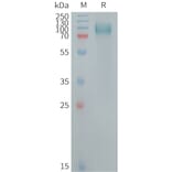 SDS-PAGE - Recombinant Human GPNMB Protein (6×His Tag) (A317722) - Antibodies.com