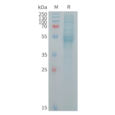 SDS-PAGE - Recombinant Human KREMEN2 Protein (6×His Tag) (A317724) - Antibodies.com