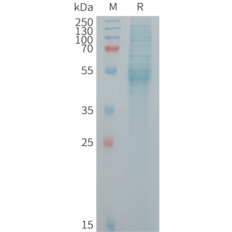 SDS-PAGE - Recombinant Human KREMEN2 Protein (6×His Tag) (A317724) - Antibodies.com