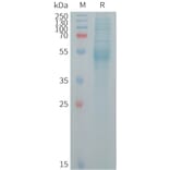 SDS-PAGE - Recombinant Human KREMEN2 Protein (6×His Tag) (A317724) - Antibodies.com