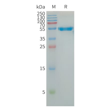 SDS-PAGE - Recombinant Human LAIR1 Protein (Fc Tag) (A317725) - Antibodies.com