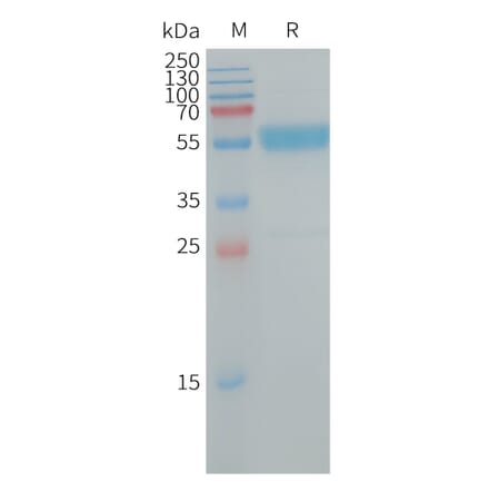 SDS-PAGE - Recombinant Human IL-19 Protein (Fc Tag) (A317727) - Antibodies.com