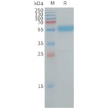 SDS-PAGE - Recombinant Human IL-19 Protein (Fc Tag) (A317727) - Antibodies.com