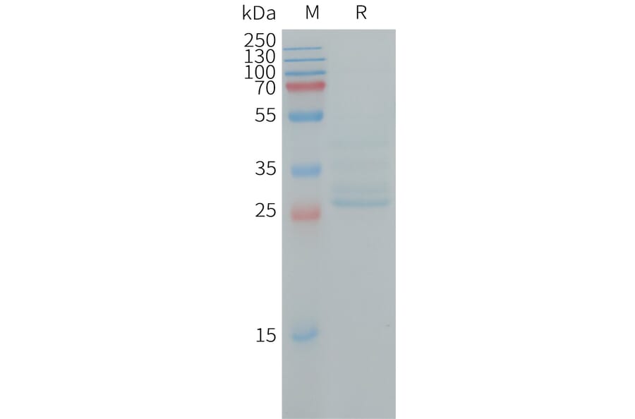 SDS-PAGE - Recombinant Human Ninjurin 1 Protein (Fc Tag) (A317728) - Antibodies.com