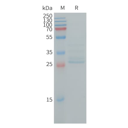 SDS-PAGE - Recombinant Human Ninjurin 1 Protein (Fc Tag) (A317728) - Antibodies.com