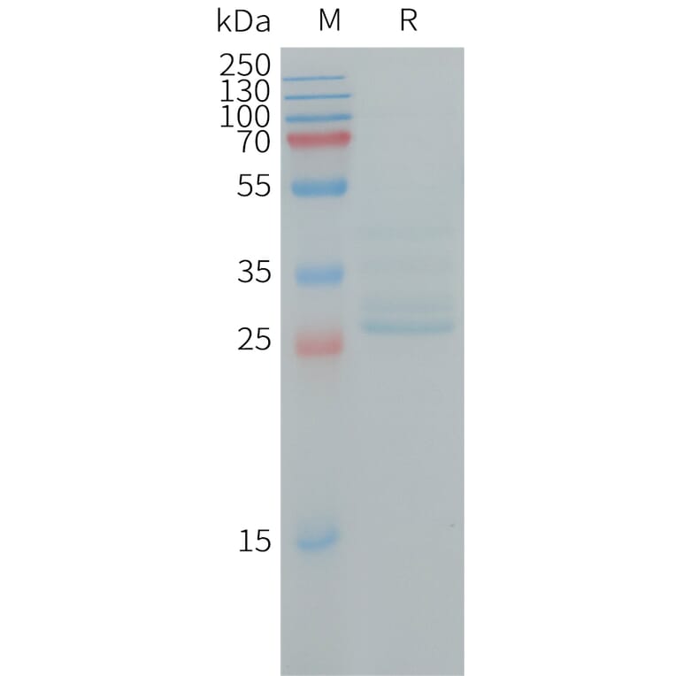 SDS-PAGE - Recombinant Human Ninjurin 1 Protein (Fc Tag) (A317728) - Antibodies.com