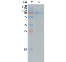 SDS-PAGE - Recombinant Human IL-20R1 Protein (Fc Tag) (A317729) - Antibodies.com