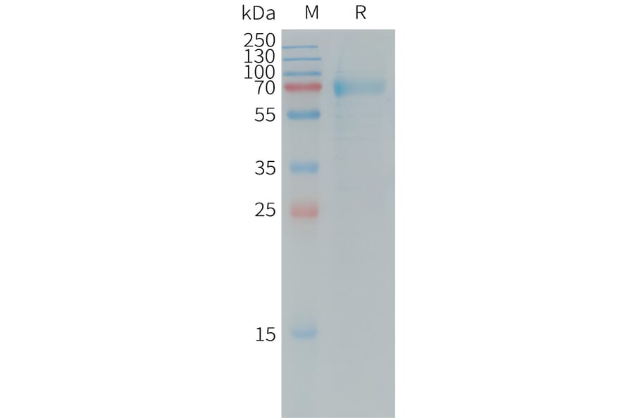 SDS-PAGE - Recombinant Human IL-20R1 Protein (Fc Tag) (A317729) - Antibodies.com