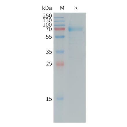 SDS-PAGE - Recombinant Human IL-20R1 Protein (Fc Tag) (A317729) - Antibodies.com