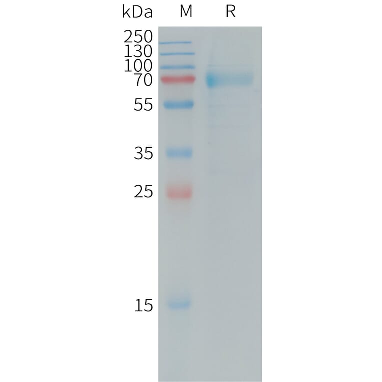 SDS-PAGE - Recombinant Human IL-20R1 Protein (Fc Tag) (A317729) - Antibodies.com