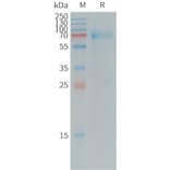 SDS-PAGE - Recombinant Human IL-20R1 Protein (Fc Tag) (A317729) - Antibodies.com