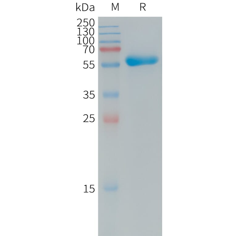 SDS-PAGE - Recombinant Human Coxsackie Adenovirus Receptor/hCAR Protein (Fc Tag) (A317730) - Antibodies.com