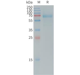 SDS-PAGE - Recombinant Human DKK1 Protein (Fc Tag) (A317731) - Antibodies.com
