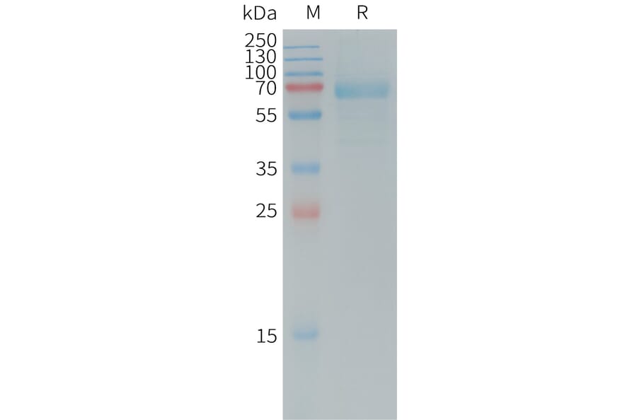 SDS-PAGE - Recombinant Human DKK1 Protein (Fc Tag) (A317731) - Antibodies.com