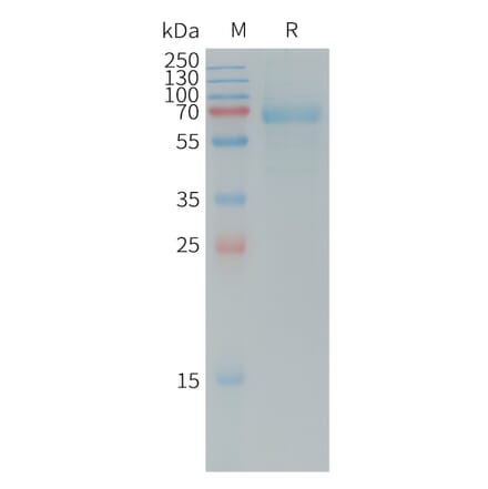 SDS-PAGE - Recombinant Human DKK1 Protein (Fc Tag) (A317731) - Antibodies.com