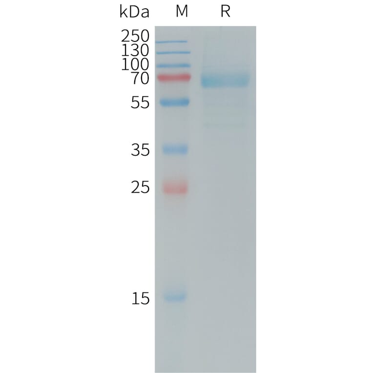 SDS-PAGE - Recombinant Human DKK1 Protein (Fc Tag) (A317731) - Antibodies.com