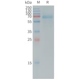 SDS-PAGE - Recombinant Human DKK1 Protein (Fc Tag) (A317731) - Antibodies.com