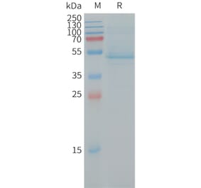 SDS-PAGE - Recombinant Human RhoC Protein (Fc Tag) (A317732) - Antibodies.com