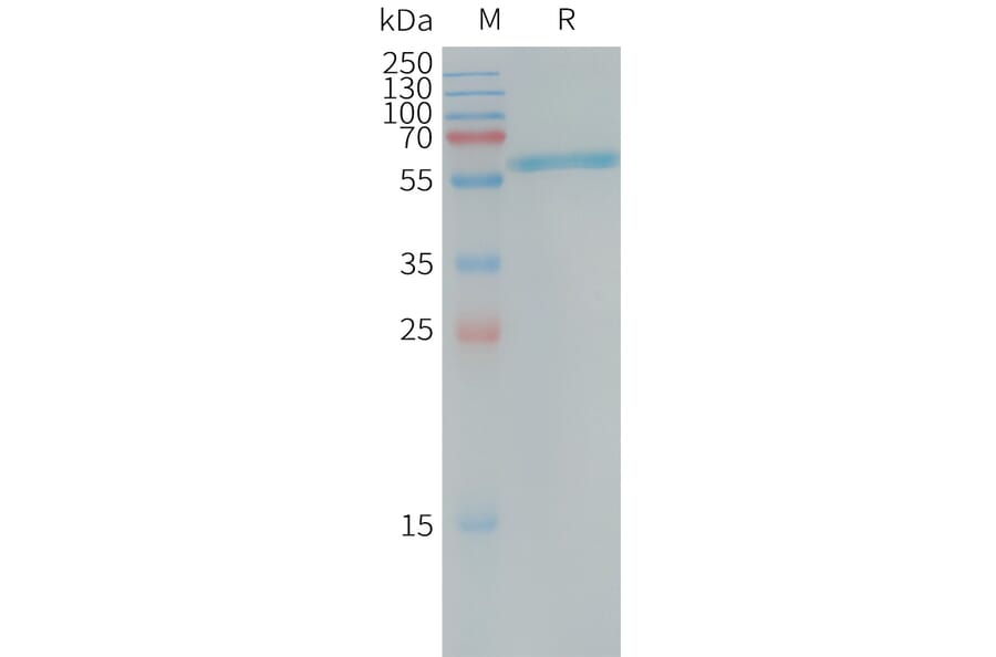 SDS-PAGE - Recombinant Human Placental Alkaline Phosphatase (PLAP) Protein (6×His Tag) (A317734) - Antibodies.com