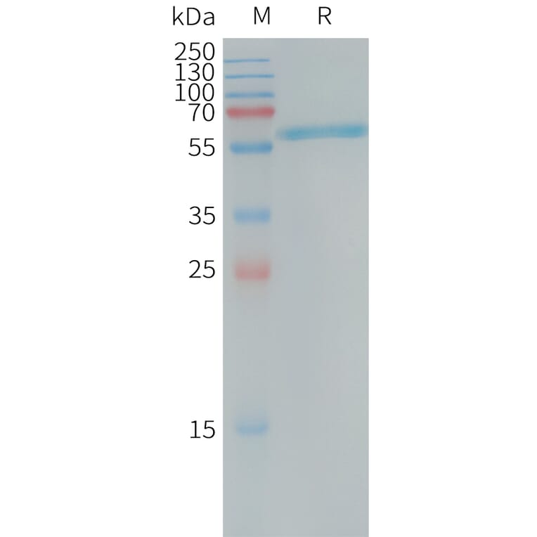 SDS-PAGE - Recombinant Human Placental Alkaline Phosphatase (PLAP) Protein (6×His Tag) (A317734) - Antibodies.com