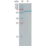 SDS-PAGE - Recombinant Human Placental Alkaline Phosphatase (PLAP) Protein (6×His Tag) (A317734) - Antibodies.com