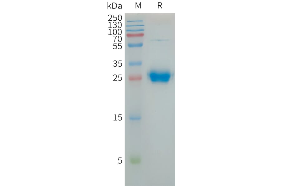 SDS-PAGE - Recombinant Human Coxsackie Adenovirus Receptor/hCAR Protein (6×His Tag) (A317735) - Antibodies.com