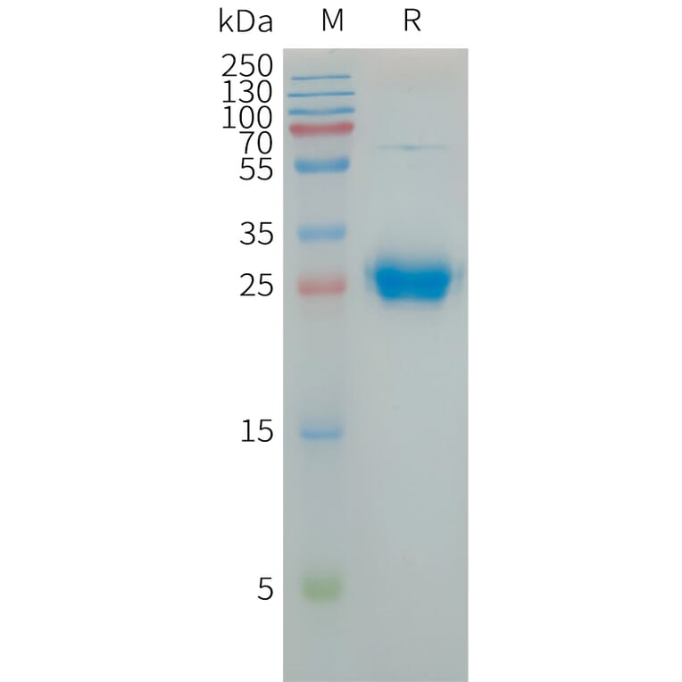 SDS-PAGE - Recombinant Human Coxsackie Adenovirus Receptor/hCAR Protein (6×His Tag) (A317735) - Antibodies.com