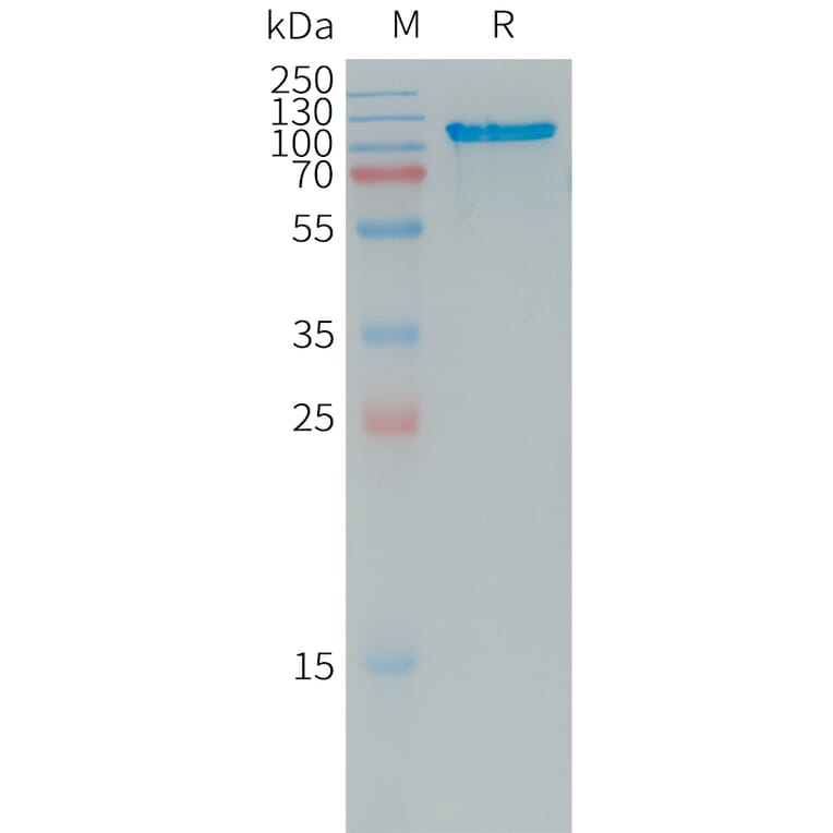 SDS-PAGE - Recombinant Human APLP2 Protein (6×His Tag) (A317736) - Antibodies.com