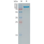 SDS-PAGE - Recombinant Human APLP2 Protein (6×His Tag) (A317736) - Antibodies.com