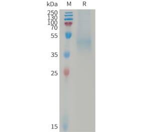 SDS-PAGE - Recombinant Human DKK1 Protein (6×His Tag) (A317737) - Antibodies.com