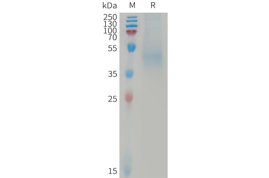SDS-PAGE - Recombinant Human DKK1 Protein (6×His Tag) (A317737) - Antibodies.com