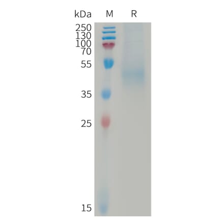 SDS-PAGE - Recombinant Human DKK1 Protein (6×His Tag) (A317737) - Antibodies.com