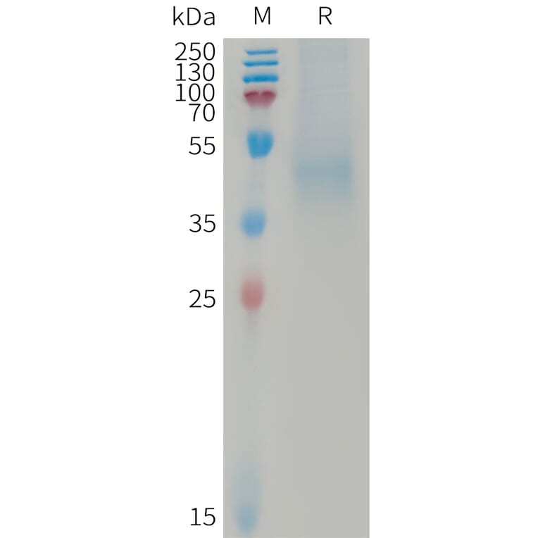 SDS-PAGE - Recombinant Human DKK1 Protein (6×His Tag) (A317737) - Antibodies.com