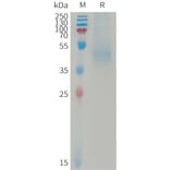 SDS-PAGE - Recombinant Human DKK1 Protein (6×His Tag) (A317737) - Antibodies.com