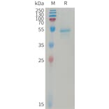 SDS-PAGE - Recombinant Human IL-23A Protein (Fc Tag) + IL23B Protein (6×His Tag) Heterodimer (A317738) - Antibodies.com