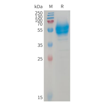 SDS-PAGE - Recombinant Human BTC Protein (Fc Tag) (A317740) - Antibodies.com
