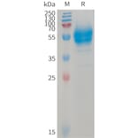SDS-PAGE - Recombinant Human BTC Protein (Fc Tag) (A317740) - Antibodies.com