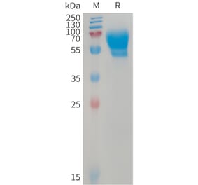 SDS-PAGE - Recombinant Human ALK-1 Protein (Fc Tag) (A317741) - Antibodies.com