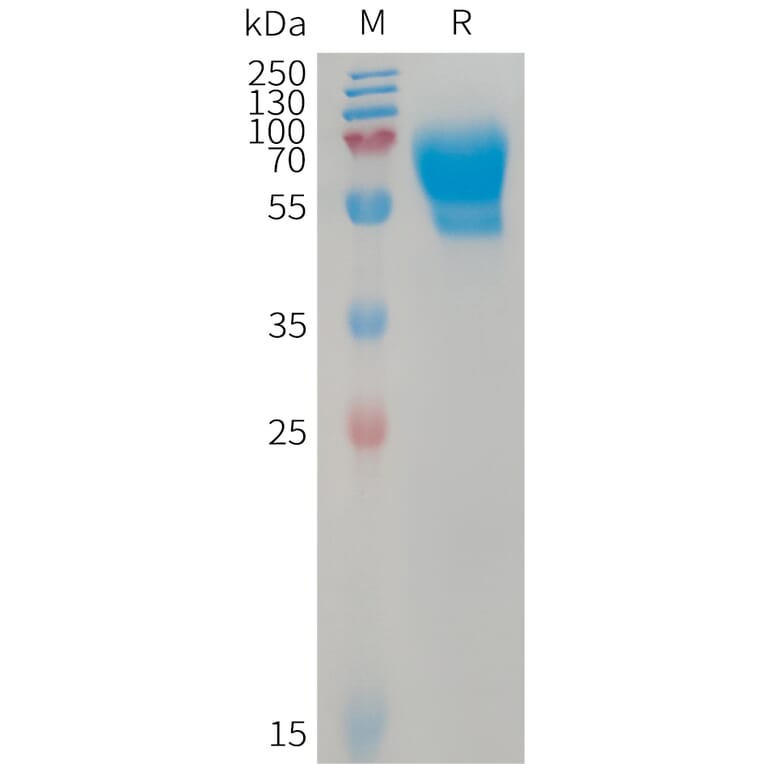 SDS-PAGE - Recombinant Human ALK-1 Protein (Fc Tag) (A317741) - Antibodies.com