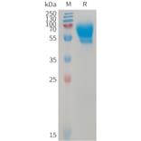 SDS-PAGE - Recombinant Human ALK-1 Protein (Fc Tag) (A317741) - Antibodies.com