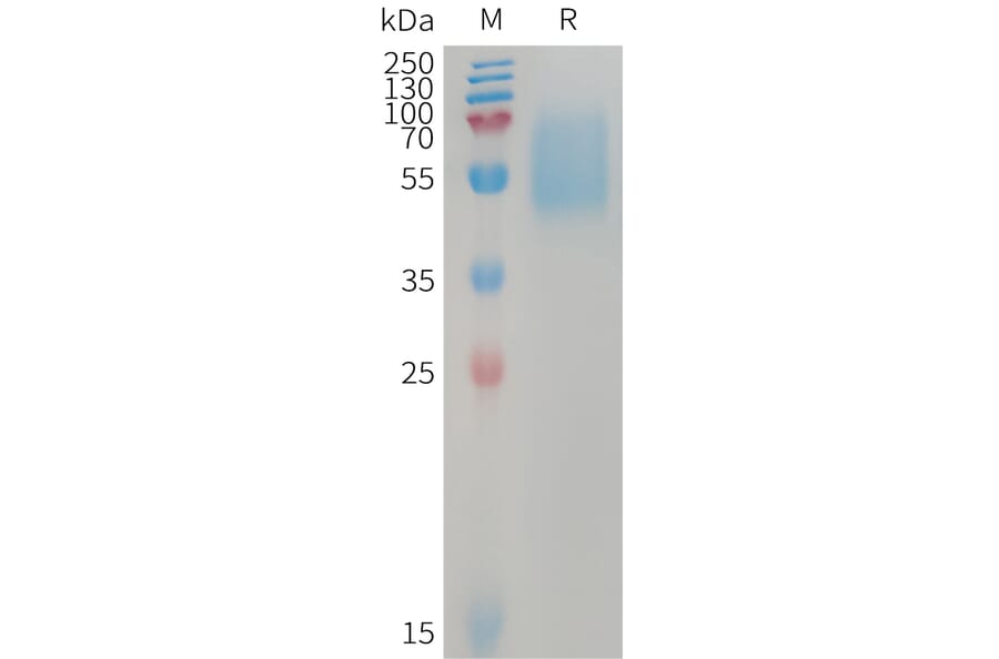 SDS-PAGE - Recombinant Human ALK-7 Protein (Fc Tag) (A317742) - Antibodies.com