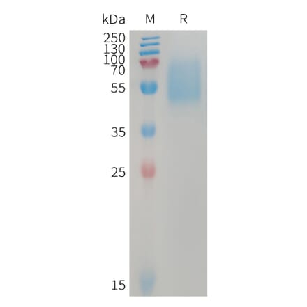 SDS-PAGE - Recombinant Human ALK-7 Protein (Fc Tag) (A317742) - Antibodies.com