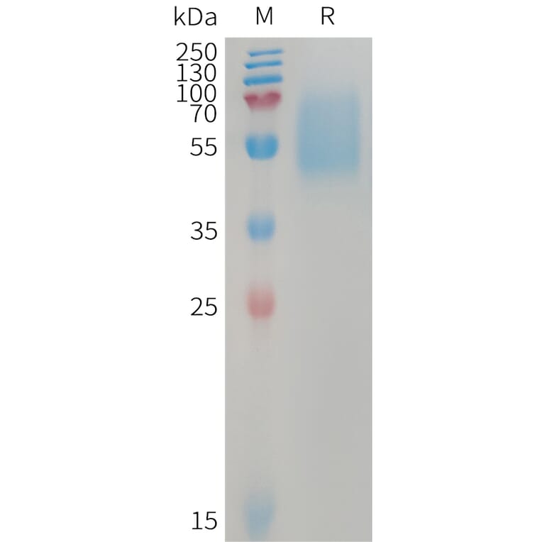 SDS-PAGE - Recombinant Human ALK-7 Protein (Fc Tag) (A317742) - Antibodies.com