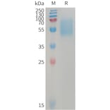 SDS-PAGE - Recombinant Human ALK-7 Protein (Fc Tag) (A317742) - Antibodies.com