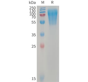 SDS-PAGE - Recombinant Human LYPD3 Protein (6×His Tag) (A317743) - Antibodies.com