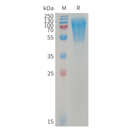 SDS-PAGE - Recombinant Human LYPD3 Protein (6×His Tag) (A317743) - Antibodies.com