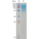 SDS-PAGE - Recombinant Human LYPD3 Protein (6×His Tag) (A317743) - Antibodies.com