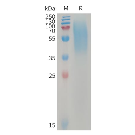 SDS-PAGE - Recombinant Human LYPD3 Protein (6×His Tag) (A317744) - Antibodies.com
